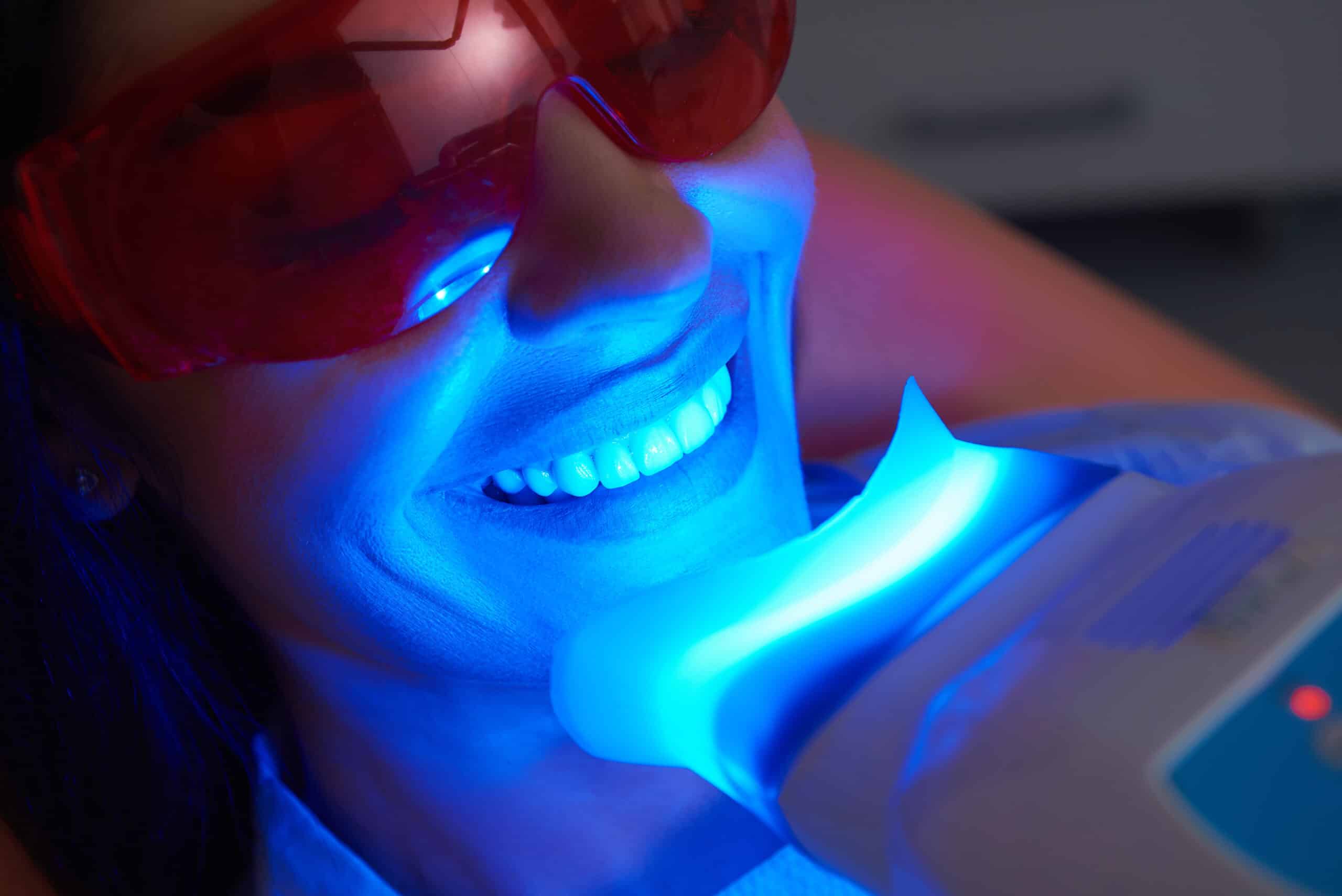 teeth whitening near me