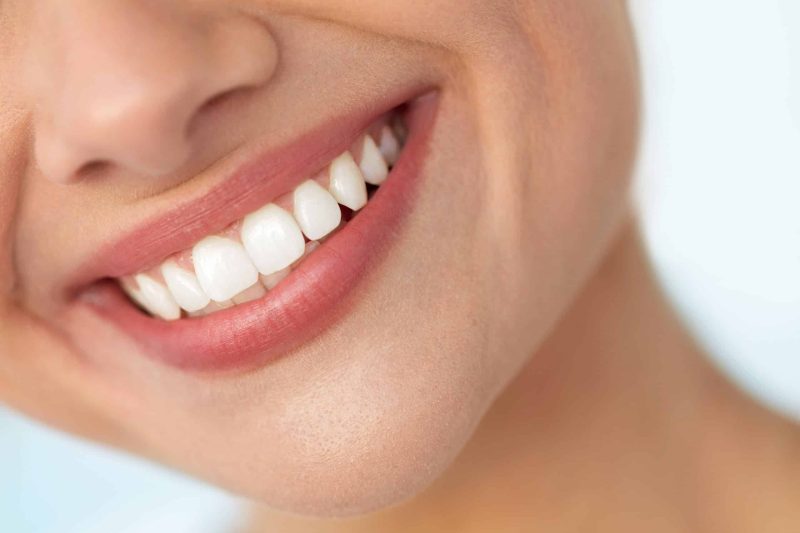 teeth whitening near me